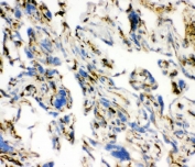 IHC staining of frozen human placenta with ACE antibody. 