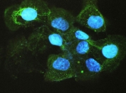 Immunofluorescent testing of human A431 cells with ACE antibody (green) and DAPI (blue). HIER: boil tissue sections in pH6, 10mM citrate buffer, for 20 min and allow to cool before testing.