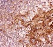 IHC-P: Annexin A1 antibody testing of human tonsil tissue. HIER: boil tissue sections in pH8 EDTA for 20 min and allow to cool before testing.