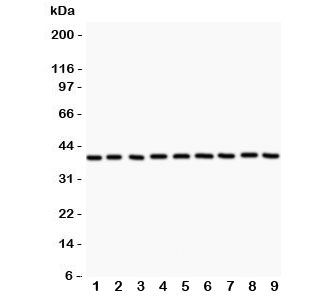 Western blot testing of APE1 antibody and Lane 1: rat NRK; 2: human HeLa; 3: (r) PC12; 4: (r) RH35; 5: mouse HEPA; 6: (h) MCF7: (h) A549; 8: (h) placenta; 9: (h) A431. Expected/observed size ~38KD