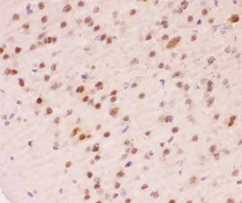 IHC-P staining of mouse brain tissue