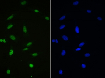 IF/ICC staining of FFPE human U-2 OS cells with APE1 antibody (green) at 2ug/ml and DAPI nuclear stain (blue). HIER: steam section in pH6 citrate buffer for 20 min.