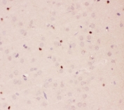 IHC-P staining of rat brain tissue. HIER: steam section in pH6 citrate buffer for 20 min.