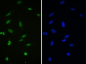 IF/ICC staining of FFPE human U-2 OS cells with APE1 antibody (green) at 2ug/ml and DAPI nuclear stain (blue). HIER: steam section in pH6 citrate buffer for 20 min.