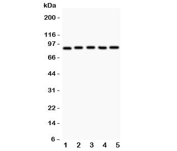 Western blot testing of HIF-1 beta antibody and Lane 1: HeLa; 2: 293T; 3: Jurkat; 4: U87; Lane5: COLO320. Expected/observed size ~87KD~