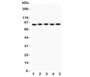 Western blot testing of HIF-1 beta antibody and Lane 1:  HeLa;  2: 293T;  3: Jurkat;  4: U87;  Lane5: COLO320.  Expected/observed size ~87KD