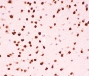 IHC testing of FFPE mouse brain tissue with ATF2 antibody at 1ug/ml. Required HIER: steam section in pH6 citrate buffer for 20 min and allow to cool prior to staining.