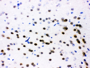 IHC testing of frozen mouse brain tissue with ATF2 antibody at 1ug/ml.