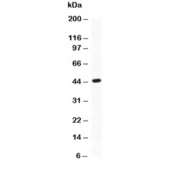 Western blot testing of ATF2 antibody and recombinant human protein (0.5ng).