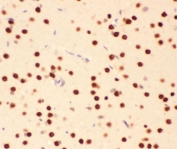 IHC testing of FFPE rat brain tissue with ATF2 antibody at 1ug/ml. Required HIER: steam section in pH6 citrate buffer for 20 min and allow to cool prior to staining.