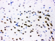 IHC testing of frozen mouse brain tissue with ATF2 antibody at 1ug/ml.