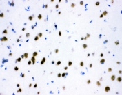 IHC testing of frozen rat brain tissue with ATF2 antibody at 1ug/ml.