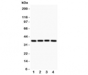 Western blot testing of MCL1 antibody and Lane 1:  rat spleen;  2: human HEPG2;  3: (h) MCF-7;  4: (h) COLO320. Predicted molecular weight ~37kDa.