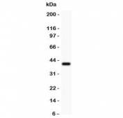 Western blot testing of Bub1 antibody and recombinant human partial protein (0.5ng)