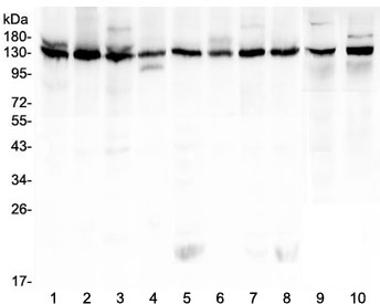 Western blot testing of human 1) K562, 2) HeLa, 3) 293T, 4) A431, 5) Caco-2, 6) PC-3, 7) MCF7, 8) U-2 OS, 9) rat testis and 10) mouse testis lysate with Bub1 antibody at 0.5ug/ml. Predicted molecular weight ~122 kDa.~