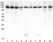 Western blot testing of human 1) K562, 2) HeLa, 3) 293T, 4) A431, 5) Caco-2, 6) PC-3, 7) MCF7, 8) U-2 OS, 9) rat testis and 10) mouse testis lysate with Bub1 antibody at 0.5ug/ml. Predicted molecular weight ~122 kDa.
