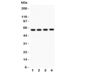 Western blot testing of SynCAM antibody and Lane 1:  rat brain;  2: human HeLa;  3: (h) A549;  4: (h) Jurkat.  Predicted molecular weight: ~48/37 kDa (isoforms 1/2) with N-linked and O-linked glycosylation each possibly adding ~25 kDa to the observed size.