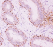 IHC testing of FFPE human breast tissue with alpha Catenin antibody at 1ug/ml. Required HIER: steam section in pH6 citrate buffer for 20 min and allow to cool prior to staining.