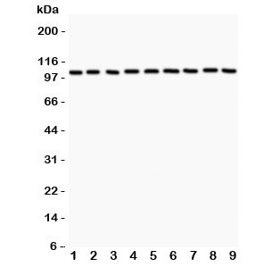 Western blot testing of alpha Catenin antibody and Lane 1: rat liver; 2: (r) lung; 3: (r) heart; 4: mouse NIH3T3; 5: (r) PC12; 6: human HEPG2; 7: (h) HeLa; 8: (h) MCF-7; 9: (m) HEPA. Expected/observed size ~102KD