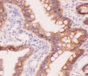 IHC testing of FFPE rat intestine tissue with alpha Catenin antibody at 1ug/ml. Required HIER: steam section in pH6 citrate buffer for 20 min and allow to cool prior to staining.