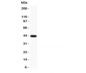 Western blot testing of LFA-1 antibody and recombinant human partial protein (0.5ng/lane).