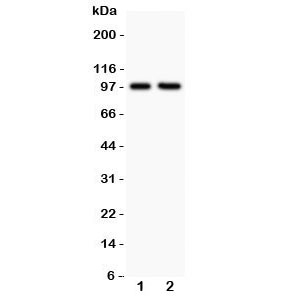 Western blot testing of LFA-1 antibody and Lane 1: Jurkat; 2: CEM; Predicted/Observed size: 85~95KD depending on glycosylation level
