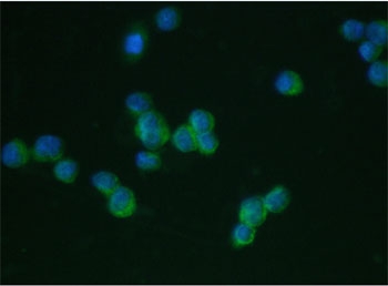 Immunofluorescent staining of human THP1 cells with LFA-1 antibody at 2ug/ml. HIER: boil tissue sections in pH6, 10mM citrate buffer, for 10-20 min followed by cooling at RT for 20 min.