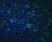 Immunofluorescent staining of human tonsil tissue with LFA-1 antibody (green) at 1ug/ml and DAPI nuclear counterstain (blue). HIER: boil tissue sections in pH6, 10mM citrate buffer, for 10-20 min followed by cooling at RT for 20 min.
