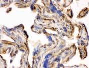 IHC staining of frozen human placenta with Laminin antibody. HIER: boil tissue sections in pH6, 10mM citrate buffer, for 20 min and allow to cool before testing.