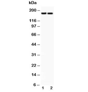 Western blot testing of Laminin antibody and Lane 1: HeLa; 2: HEPG2 lysate