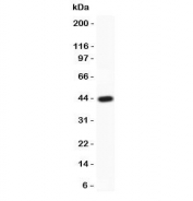 Western blot testing of MyD88 antibody and recombinant human protein (0.5ng)