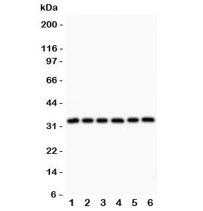 Western blot testing of MyD88 antibody and Lane 1: rat heart; 2: human HeLa; 3: (h) MCF7; 4: (h) HEPG2; 5: (h) Jurkat; 6: (h) Raji. Predicted molecular weight: 33 kDa