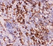 IHC-P staining of mouse spleen tissue with MyD88 antibody. HIER: boil tissue sections in pH6, 10mM citrate buffer, for 20 min and allow to cool before testing.
