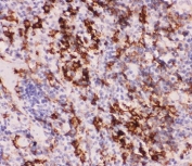 IHC-P staining of mouse spleen tissue with MyD88 antibody. HIER: boil tissue sections in pH6, 10mM citrate buffer, for 20 min and allow to cool before testing.