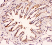 IHC-P staining of rat lung tissue with MyD88 antibody. HIER: boil tissue sections in pH6, 10mM citrate buffer, for 20 min and allow to cool before testing.