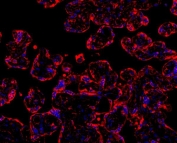 Immunofluorescent staining of human placenta with MyD88 antibody (red) and DAPI nuclear stain (blue).