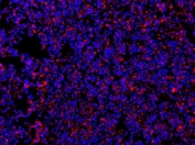 Immunofluorescent staining of human tonsil with MyD88 antibody (red) and DAPI nuclear stain (blue).