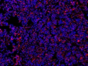 Immunofluorescent staining of human tonsil with MyD88 antibody (red) and DAPI nuclear stain (blue).