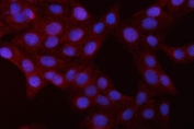 Immunofluorescent staining of FFPE human U-2 OS cells with p50 antibody (red) and DAPI nuclear stain (blue). HIER: steam section in pH6 citrate buffer for 20 min.