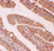 IHC staining of FFPE mouse intestine tissue with NFKB2 antibody. HIER: boil tissue sections in pH8 EDTA for 20 min and allow to cool before testing.