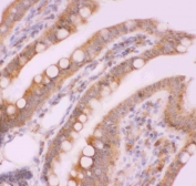 IHC staining of FFPE rat intestine tissue with NFKB2 antibody. HIER: boil tissue sections in pH8 EDTA for 20 min and allow to cool before testing.