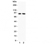Western blot testing of NHE1 antibody and Lane 1:  rat PC12;  2: human MCF-7.  Predicted/observed size ~91KD