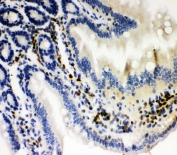IHC staining of FFPE mouse intestine with RUNX1 antibody. HIER: boil tissue sections in pH6, 10mM citrate buffer, for 20 min and allow to cool before testing.