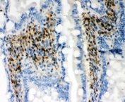 IHC staining of FFPE rat intestine with RUNX1 antibody. HIER: boil tissue sections in pH6, 10mM citrate buffer, for 20 min and allow to cool before testing.