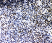 IHC staining of FFPE rat thymus with RUNX1 antibody. HIER: boil tissue sections in pH6, 10mM citrate buffer, for 20 min and allow to cool before testing.