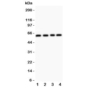 Western blot testing of RUNX2 antibody and Lane 1: HeLa; 2: A431; 3: K562; 4: Jurkat. Predicted molecular weight: 50-60 kDa.~