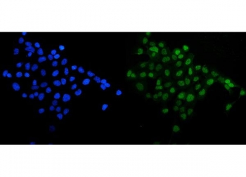 Immunofluorescent staining of FFPE human A431 cells with SIRT1 antibody (green) and DAPI nuclear stain (blue). HIER: steam section in pH6 citrate buffer for 20 min.~