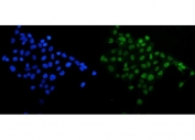 Immunofluorescent staining of FFPE human A431 cells with SIRT1 antibody (green) and DAPI nuclear stain (blue). HIER: steam section in pH6 citrate buffer for 20 min.