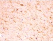 IHC-P testing of mouse brain tissue