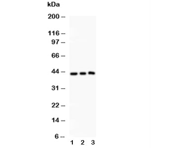 Western blot testing of SIRT2 antibody and Lane 1: rat spleen; 2: HeLa; 3: A549